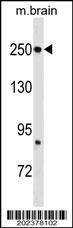 Anti-FASN Mouse Monoclonal Antibody [clone: 497CT15.2.5]