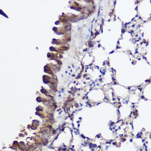 Immunohistochemistry analysis of paraffin-embedded mouse lung using Anti-Abca8a Antibody (A306614) at a dilution of 1:100 (40X lens). Perform high pressure antigen retrieval with 10 mM citrate buffer pH 6.0 before commencing with IHC staining protocol