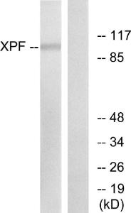 Western blot analysis of lysates from 293 cells using Anti-XPF Antibody. The right hand lane represents a negative control, where the antibody is blocked by the immunising peptide.