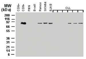 Anti-MALT1 Rabbit Polyclonal Antibody