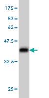 Anti-CHST11 Mouse Monoclonal Antibody [clone: 4F1]