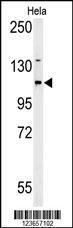 Anti-ADCY4 Rabbit Polyclonal Antibody (FITC (Fluorescein Isothiocyanate))