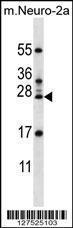 Anti-RPL15 Rabbit Polyclonal Antibody