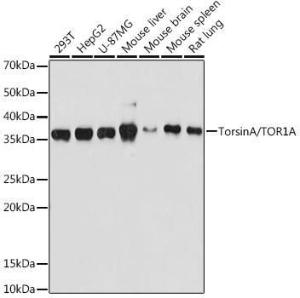 Anti-Torsin A/DYT1 antibody