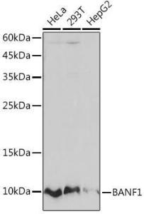 Western blot analysis of extracts of various cell lines, using Anti-BANF1/BAF Antibody [ARC2085] (A307950) at 1:1000 dilution. The secondary Antibody was Goat Anti-Rabbit IgG H&L Antibody (HRP) at 1:10000 dilution. Lysates/proteins were present at 25 µg per lane