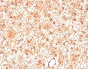 Immunohistochemical analysis of formalin-fixed, paraffin-embedded human brain tissue using Anti-PKC iota Antibody [PRKCI/4911]