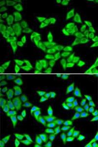 Anti-CIAPIN1 antibody