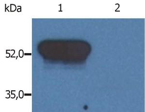 Western Blotting analysis (reducing conditions) of GFAP in porcine brain lysate. Lane 1: Immunostaining with Anti-GFAP Antibody (A85479). Lane 2: Immunostaining with Isotype mouse IgM control (PFR-03)