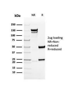 SDS-PAGE analysis of Anti-Collagen IV Antibody [rCOL4/4742] under non-reduced and reduced conditions; showing intact IgG and intact heavy and light chains, respectively SDS-PAGE analysis confirms the integrity and purity of the antibody