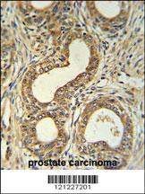 Anti-Roundabout 4 Rabbit Polyclonal Antibody