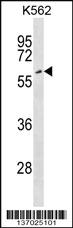 Anti-EYA2 Rabbit Polyclonal Antibody