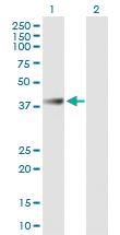 Anti-ABHD1 Mouse Polyclonal Antibody