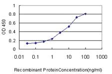 Anti-SPRED2 Mouse Monoclonal Antibody [clone: 6G8]