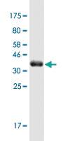 Anti-MAP4K1 Mouse Monoclonal Antibody [clone: 1G6]