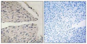 Anti-CIDE B Rabbit Polyclonal Antibody