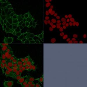 Immunofluorescent analysis of HeLa cells stained with Anti-gamma Catenin Antibody [11E4] (CFand#174; 488) (Green). Nuclear counterstain is RedDot