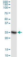 Anti-SOHLH2 Polyclonal Antibody Pair