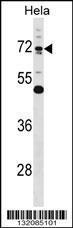 Anti-EPN1 Rabbit Polyclonal Antibody (APC (Allophycocyanin))