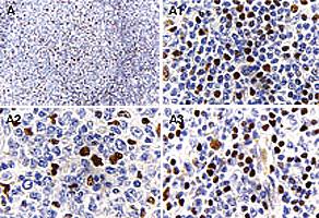 Anti-MALT1 Rabbit Polyclonal Antibody