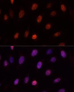 Anti-PCGF1 antibody