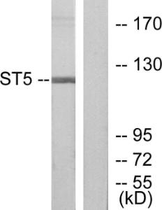 Western blot analysis of lysates from COLO205 cells using Anti-ST5 Antibody. The right hand lane represents a negative control, where the antibody is blocked by the immunising peptide