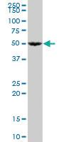 Anti-PET112 (PET112 homolog (yeast)) Mouse Polyclonal Antibody