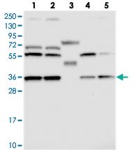 Anti-DNAJC17 Rabbit Polyclonal Antibody