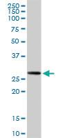 Anti-RPIA Rabbit Polyclonal Antibody