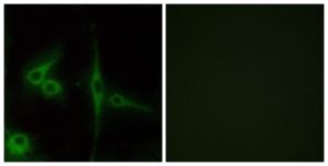 Immunofluorescence analysis of LOVO cells using Anti-ELTD1 Antibody. The right hand panel represents a negative control, where the antibody was pre-incubated with the immunising peptide.