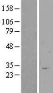 Anti-DNMT1 Mouse Monoclonal Antibody [clone: 60B1220.1]