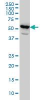 Anti-PET112 (PET112 homolog (yeast)) Mouse Monoclonal Antibody [clone: 6B2]