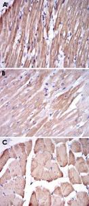 Anti-TNNT2 Mouse Monoclonal Antibody [clone: 2F12A11]