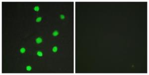 Immunofluorescence analysis of HepG2 cells using Anti-GLI-3 Antibody. The right hand panel represents a negative control, where the antibody was pre-incubated with the immunising peptide