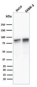 Western blot analysis of human HeLa and SK-BR-3 cell lysates using Anti-gamma Catenin Antibody [11E4]