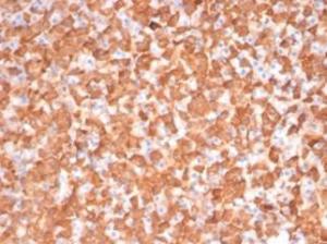 Immunohistochemical analysis of formalin-fixed, paraffin-embedded dog liver tissue using Anti-PKC iota Antibody [PRKCI/4911]