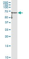 Anti-YES1 Polyclonal Antibody Pair