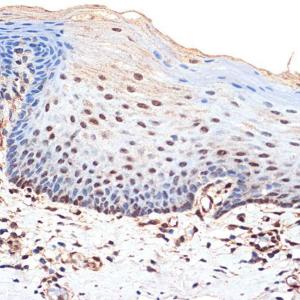 Immunohistochemistry analysis of paraffin-embedded human esophageal using Anti-BANF1/BAF Antibody [ARC2085] (A307950) at a dilution of 1:100 (40X lens). Perform microwave antigen retrieval with 10 mM Tris/EDTA buffer pH 9.0 before commencing with IHC staining protocol