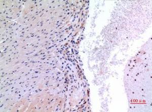 Immunohistochemical analysis of paraffin-embedded mouse heart using Anti-VEGFC Antibody