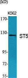 Western blot analysis of various cells using Anti-ST5 Antibody