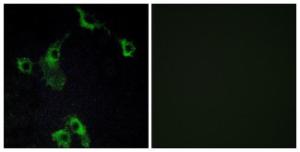 Anti-CIDE B Rabbit Polyclonal Antibody