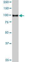 Anti-STAT6 Mouse Monoclonal Antibody [clone: 4G7]