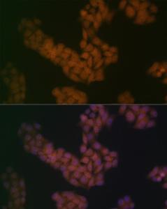 Immunofluorescence analysis of HeLa cells using Anti-BANF1/BAF Antibody [ARC2085] (A307950) at a dilution of 1:100 (40X lens). DAPI was used to stain the cell nuclei (blue)