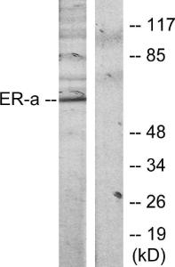 Western blot analysis of lysates from MCF7 cells, treated with Estradiol using Anti-Estrogen Receptor-alpha Antibody. The right hand lane represents a negative control, where the antibody is blocked by the immunising peptide.