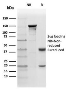 Immunohistochemical analysis of formalin-fixed, paraffin-embedded cat liver tissue using Anti-PKC iota Antibody [PRKCI/4911]