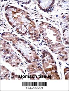 Anti-DLX5 Rabbit Polyclonal Antibody (FITC (Fluorescein Isothiocyanate))