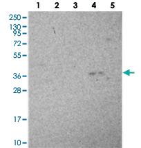 Anti-COQ9 Rabbit Polyclonal Antibody