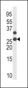 Anti-CDKN1B Rabbit Polyclonal Antibody (Biotin)