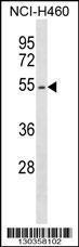 Anti-EPOR Rabbit Polyclonal Antibody (PE (Phycoerythrin))