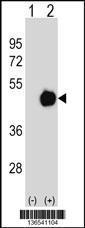 Anti-PPME1 Rabbit Polyclonal Antibody