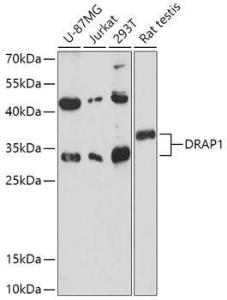 Western blot analysis of extracts of various cell lines, using Anti-NC2 alpha Antibody (A306621) at 1:1,000 dilution The secondary antibody was Goat Anti-Rabbit IgG H&L Antibody (HRP) at 1:10,000 dilution Lysates/proteins were present at 25 µg per lane